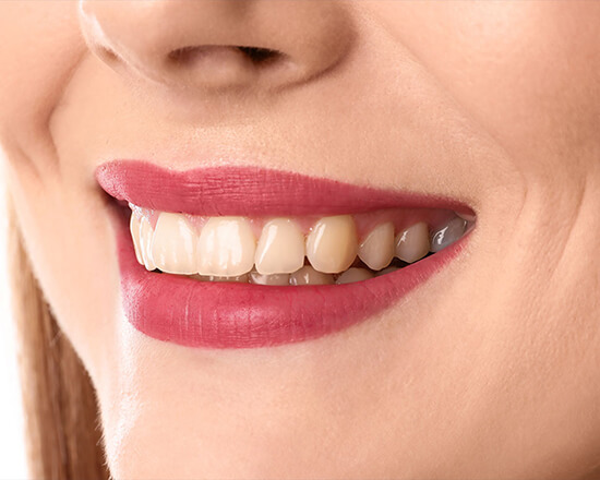 teeth_left teeth_left